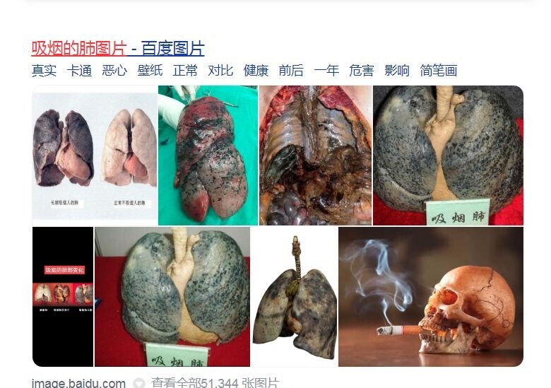 吸烟的肺图片.JPG